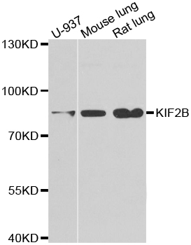 Anti-KIF2B Antibody Anti-KIF2B Antibody