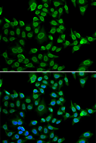 Anti-LMNB2 Antibody