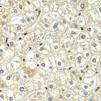Anti-LMNB2 Antibody Anti-LMNB2 Antibody