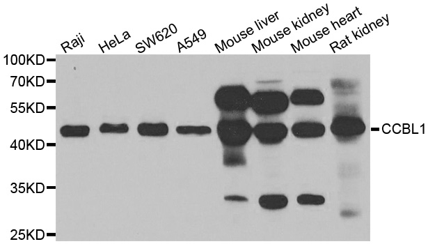 Anti-CCBL1 Antibody