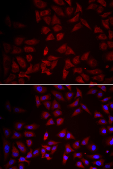 Anti-CCL25 Antibody