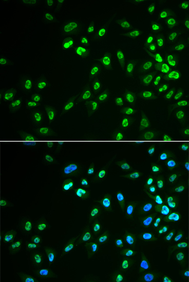 Anti-DDX41 Antibody Anti-DDX41 Antibody