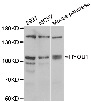 Anti-HYOU1 Antibody