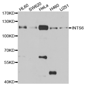 Anti-INTS6 Antibody