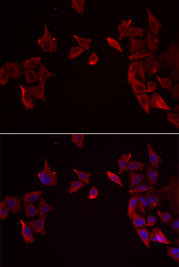 Anti-RAMP3 Antibody Anti-RAMP3 Antibody