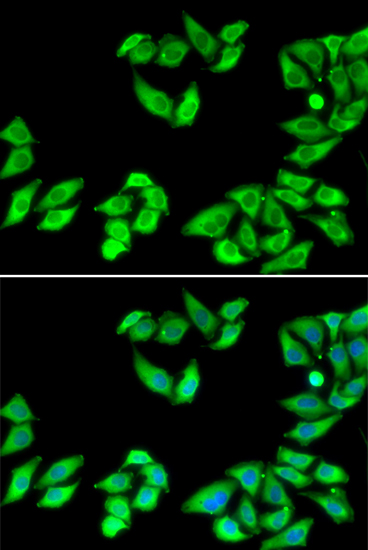 Anti-RPS14 Antibody Anti-RPS14 Antibody