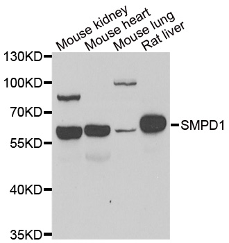 Anti-SMPD1 Antibody