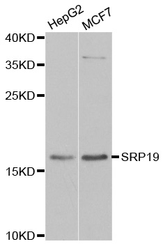 Anti-SRP19 Antibody