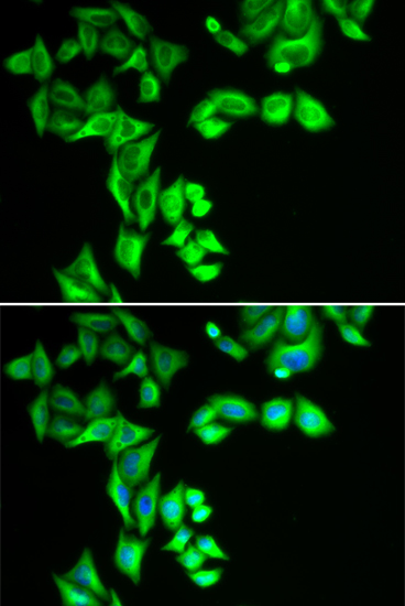 Anti-STRN3 Antibody