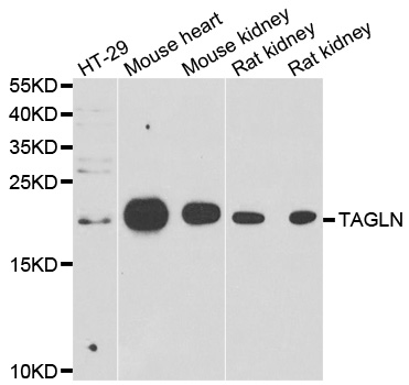 Anti-TAGLN Antibody