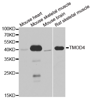 Anti-TMOD4 Antibody