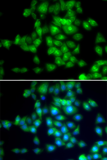 Anti-SIRT3 Antibody
