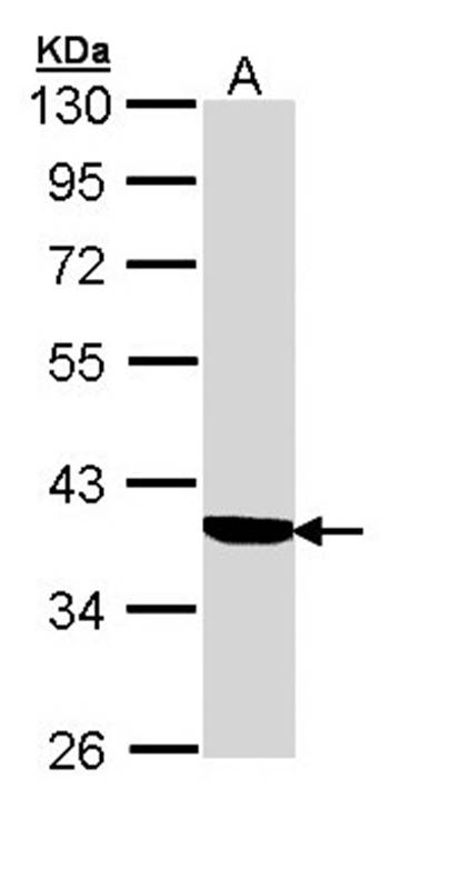 Anti-Cortisol Binding Globulin Antibody
