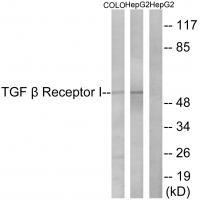 Anti-TGF beta Receptor I (Ab-165) Antibody