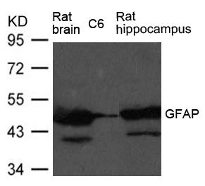 Anti-GFAP Antibody - Identical to Sigma (SAB4300647)