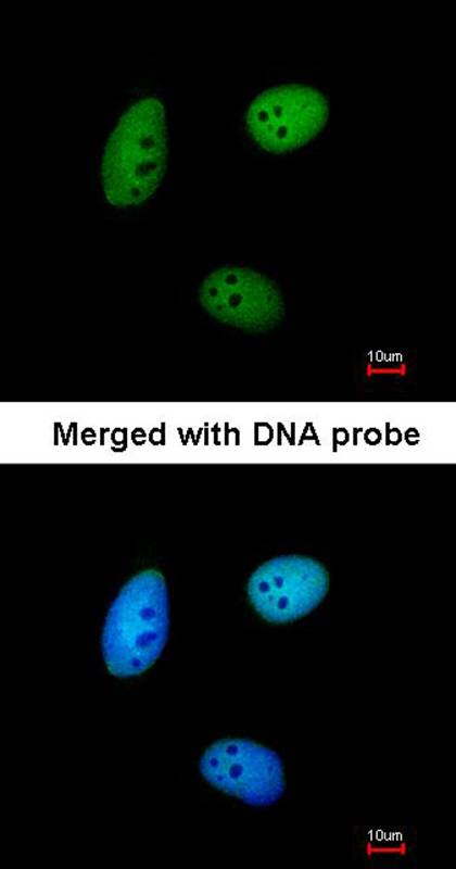 Anti-MAF1 Antibody Anti-MAF1 Antibody