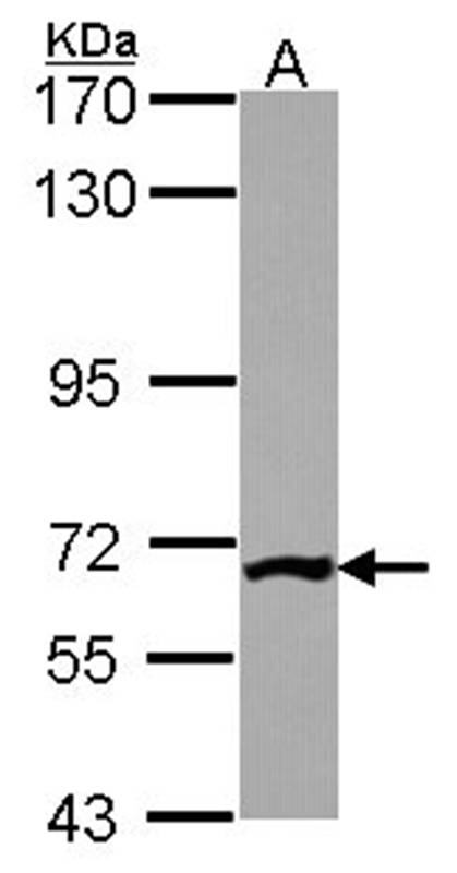 Anti-PGM3 Antibody