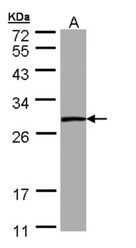 Anti-PSPH Antibody