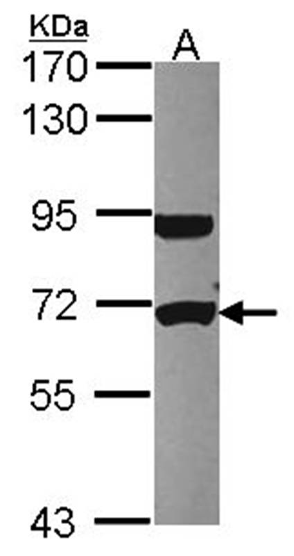 Anti-UTP6 Antibody