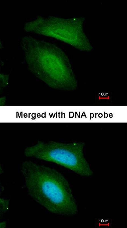 Anti-BZW2 Antibody Anti-BZW2 Antibody