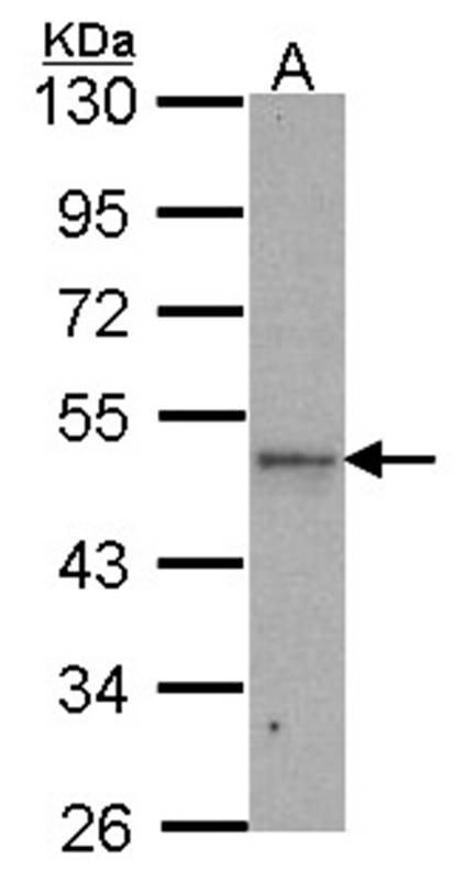 Anti-IPMK Antibody