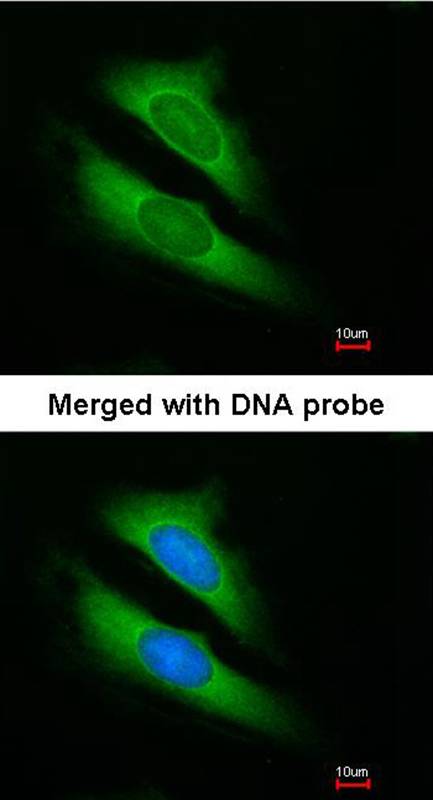 Anti-ATIC Antibody Anti-ATIC Antibody