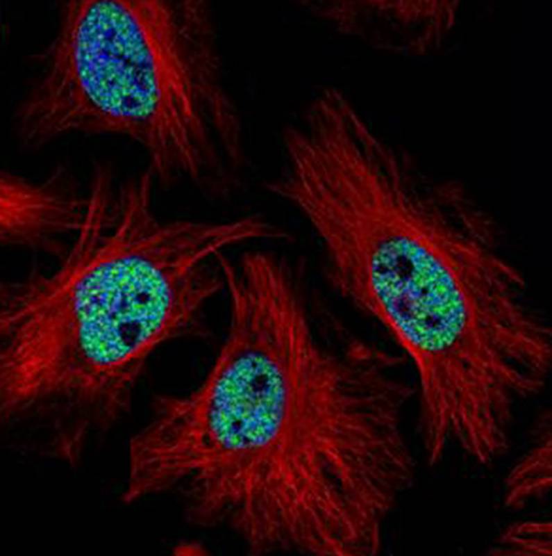 Anti-CMAS Antibody Anti-CMAS Antibody