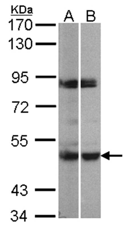 Anti-PRAK Antibody