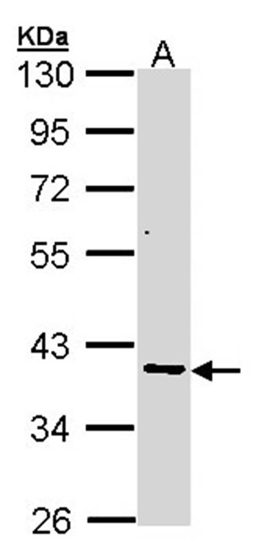 Anti-AKR7 Antibody