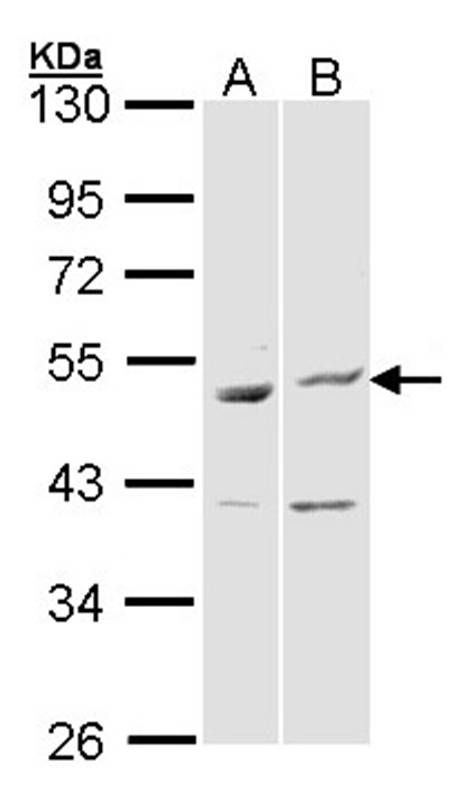 Anti-BAG5 Antibody