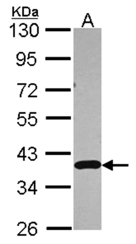 Anti-APE1 Antibody