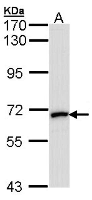 Anti-MMP2 Antibody