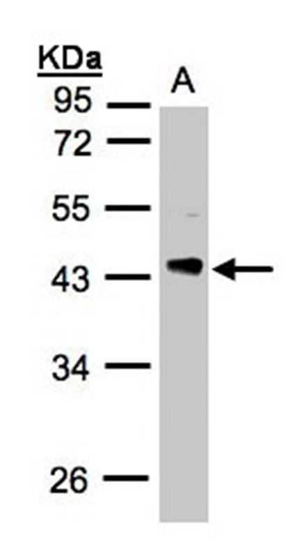 Anti-PHLP Antibody
