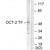 Anti-OCT2 Antibody Anti-OCT2 Antibody
