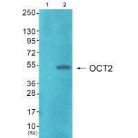 Anti-OCT2 Antibody Anti-OCT2 Antibody