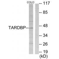 Anti-TBX1 Antibody