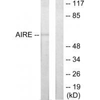 Anti-AIRE Antibody