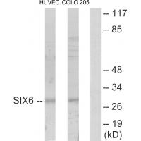 Anti-SIX6 Antibody Anti-SIX6 Antibody