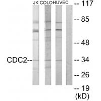 Anti-CDC2 Antibody