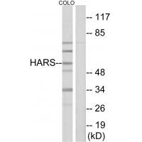 Anti-HARS Antibody