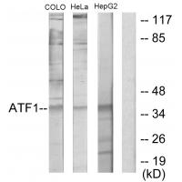 Anti-ATF1 Antibody