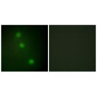 Anti-ATF1 Antibody Anti-ATF1 Antibody