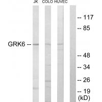 Anti-GRK6 Antibody