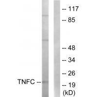 Anti-TNFC Antibody