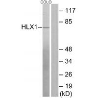 Anti-HLX1 Antibody