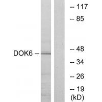 Anti-DOK6 Antibody