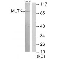 Anti-MLTK Antibody