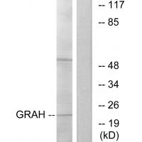 Anti-GRAH Antibody