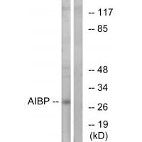 Anti-AIBP Antibody