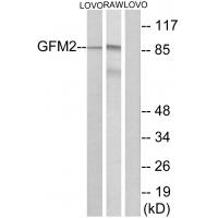 Anti-GFM2 Antibody